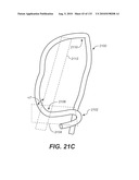 DIAGNOSTIC CATHETERS, GUIDE CATHETERS, VISUALIZATION DEVICES AND CHORD MANIPULATION DEVICES, AND RELATED KITS AND METHODS diagram and image