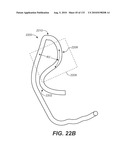 DIAGNOSTIC CATHETERS, GUIDE CATHETERS, VISUALIZATION DEVICES AND CHORD MANIPULATION DEVICES, AND RELATED KITS AND METHODS diagram and image