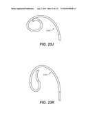 DIAGNOSTIC CATHETERS, GUIDE CATHETERS, VISUALIZATION DEVICES AND CHORD MANIPULATION DEVICES, AND RELATED KITS AND METHODS diagram and image