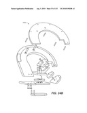 DIAGNOSTIC CATHETERS, GUIDE CATHETERS, VISUALIZATION DEVICES AND CHORD MANIPULATION DEVICES, AND RELATED KITS AND METHODS diagram and image