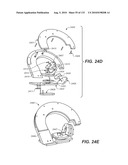 DIAGNOSTIC CATHETERS, GUIDE CATHETERS, VISUALIZATION DEVICES AND CHORD MANIPULATION DEVICES, AND RELATED KITS AND METHODS diagram and image