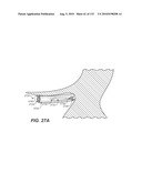 DIAGNOSTIC CATHETERS, GUIDE CATHETERS, VISUALIZATION DEVICES AND CHORD MANIPULATION DEVICES, AND RELATED KITS AND METHODS diagram and image