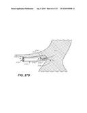 DIAGNOSTIC CATHETERS, GUIDE CATHETERS, VISUALIZATION DEVICES AND CHORD MANIPULATION DEVICES, AND RELATED KITS AND METHODS diagram and image