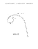 DIAGNOSTIC CATHETERS, GUIDE CATHETERS, VISUALIZATION DEVICES AND CHORD MANIPULATION DEVICES, AND RELATED KITS AND METHODS diagram and image