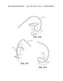 DIAGNOSTIC CATHETERS, GUIDE CATHETERS, VISUALIZATION DEVICES AND CHORD MANIPULATION DEVICES, AND RELATED KITS AND METHODS diagram and image