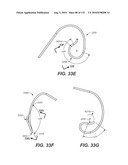 DIAGNOSTIC CATHETERS, GUIDE CATHETERS, VISUALIZATION DEVICES AND CHORD MANIPULATION DEVICES, AND RELATED KITS AND METHODS diagram and image