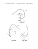 DIAGNOSTIC CATHETERS, GUIDE CATHETERS, VISUALIZATION DEVICES AND CHORD MANIPULATION DEVICES, AND RELATED KITS AND METHODS diagram and image