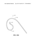 DIAGNOSTIC CATHETERS, GUIDE CATHETERS, VISUALIZATION DEVICES AND CHORD MANIPULATION DEVICES, AND RELATED KITS AND METHODS diagram and image