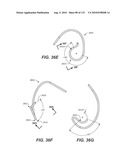 DIAGNOSTIC CATHETERS, GUIDE CATHETERS, VISUALIZATION DEVICES AND CHORD MANIPULATION DEVICES, AND RELATED KITS AND METHODS diagram and image