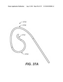 DIAGNOSTIC CATHETERS, GUIDE CATHETERS, VISUALIZATION DEVICES AND CHORD MANIPULATION DEVICES, AND RELATED KITS AND METHODS diagram and image