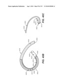 DIAGNOSTIC CATHETERS, GUIDE CATHETERS, VISUALIZATION DEVICES AND CHORD MANIPULATION DEVICES, AND RELATED KITS AND METHODS diagram and image