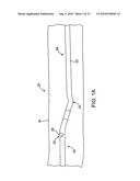 DEBULKING CATHETERS AND METHODS diagram and image