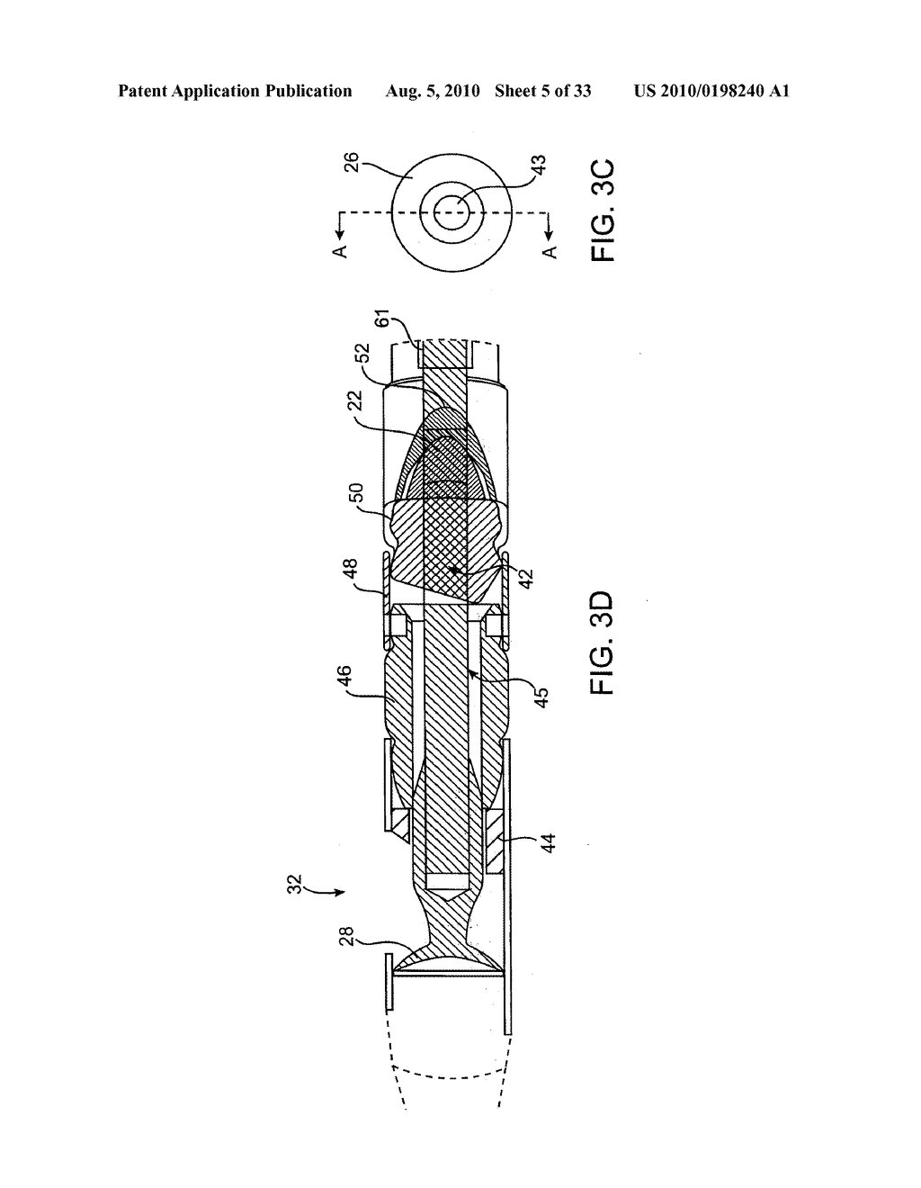 DEBULKING CATHETERS AND METHODS - diagram, schematic, and image 06