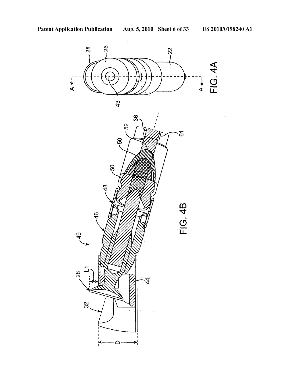 DEBULKING CATHETERS AND METHODS - diagram, schematic, and image 07