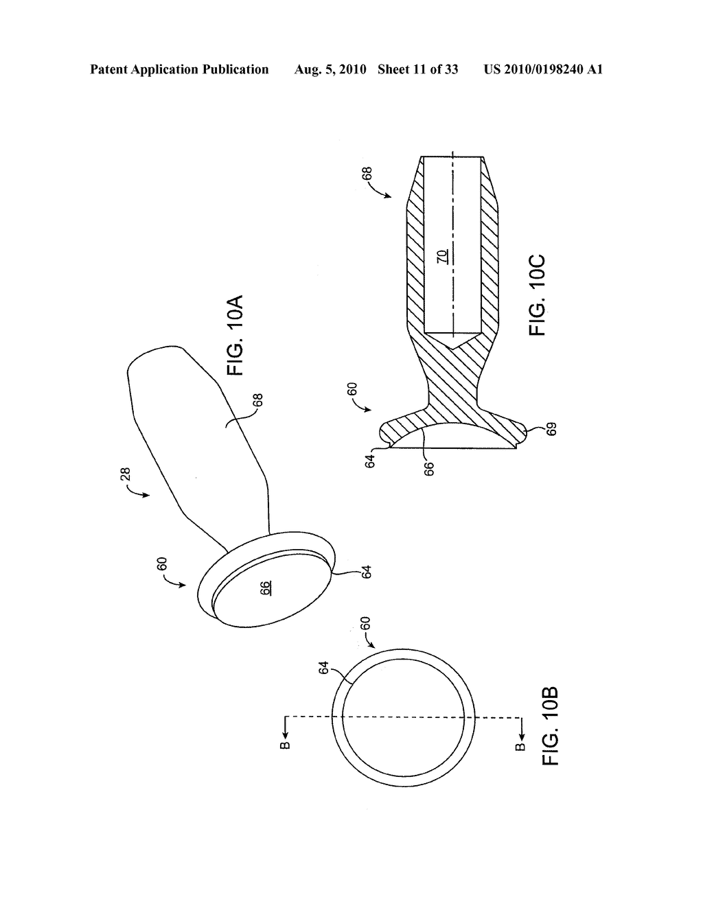 DEBULKING CATHETERS AND METHODS - diagram, schematic, and image 12