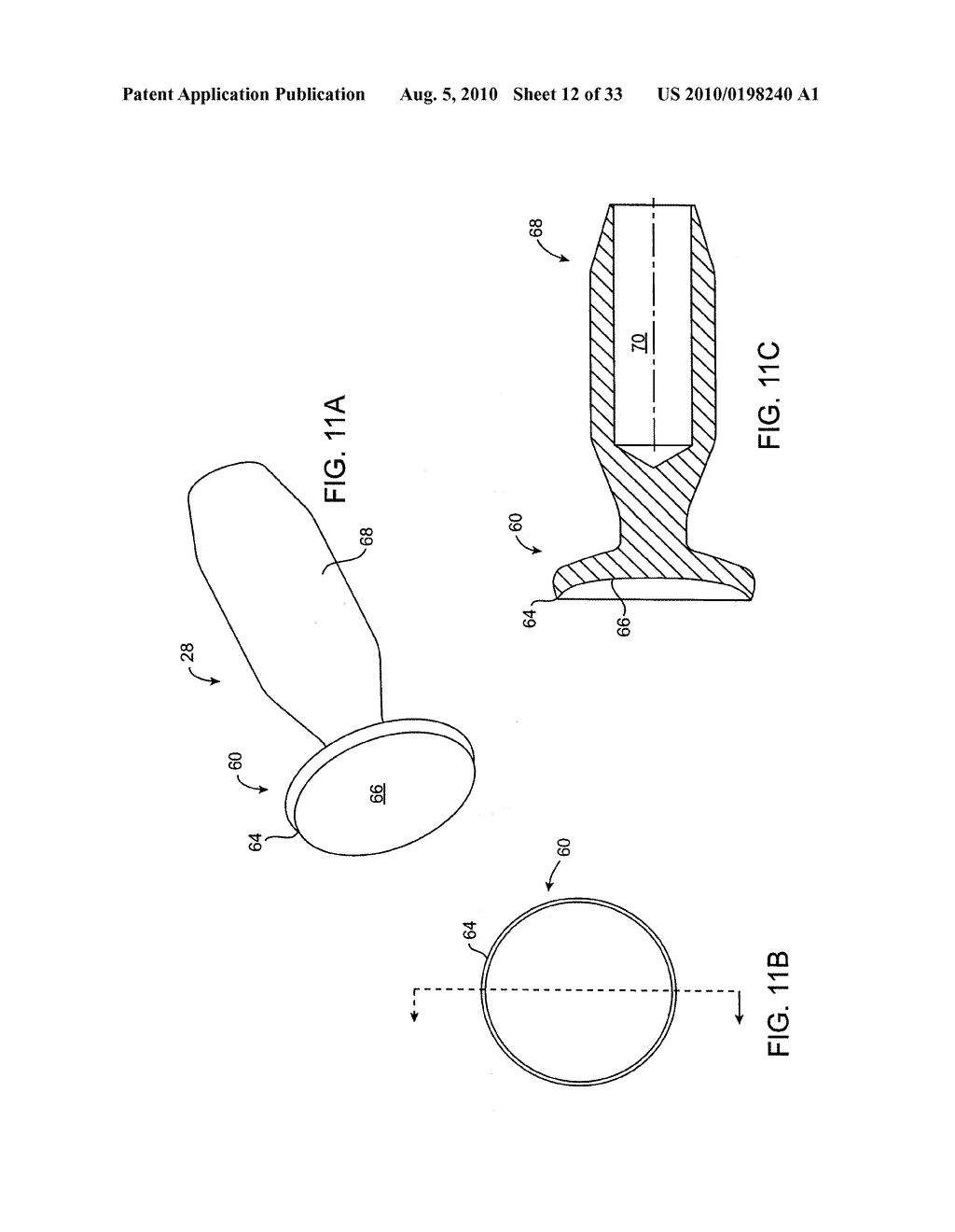 DEBULKING CATHETERS AND METHODS - diagram, schematic, and image 13