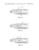 DEBULKING CATHETERS AND METHODS diagram and image