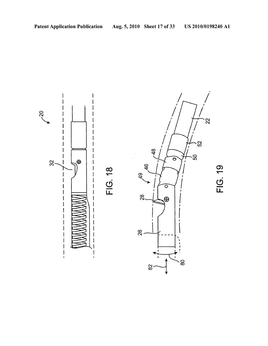 DEBULKING CATHETERS AND METHODS - diagram, schematic, and image 18