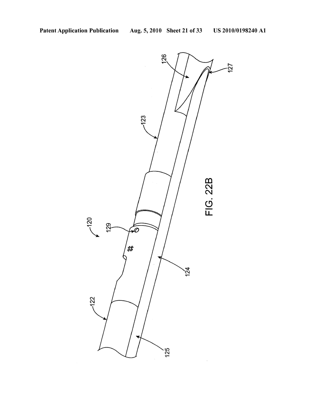 DEBULKING CATHETERS AND METHODS - diagram, schematic, and image 22