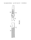 DEBULKING CATHETERS AND METHODS diagram and image