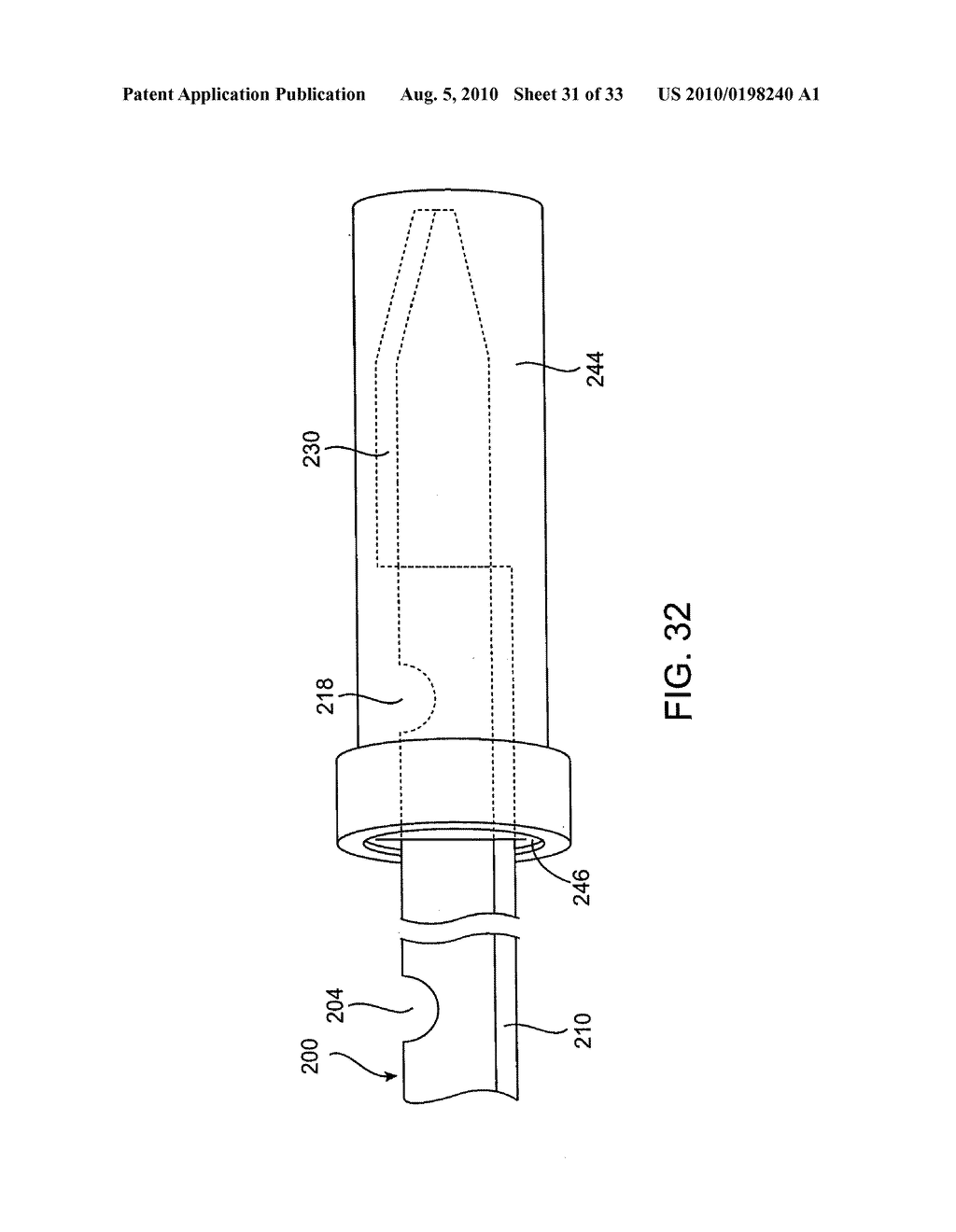 DEBULKING CATHETERS AND METHODS - diagram, schematic, and image 32