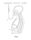 SURGICAL DISSECTOR diagram and image