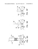 VASCULAR CLOSURE DEVICE diagram and image