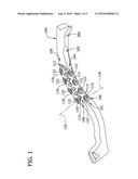 Biplanar Fracture Fixation diagram and image