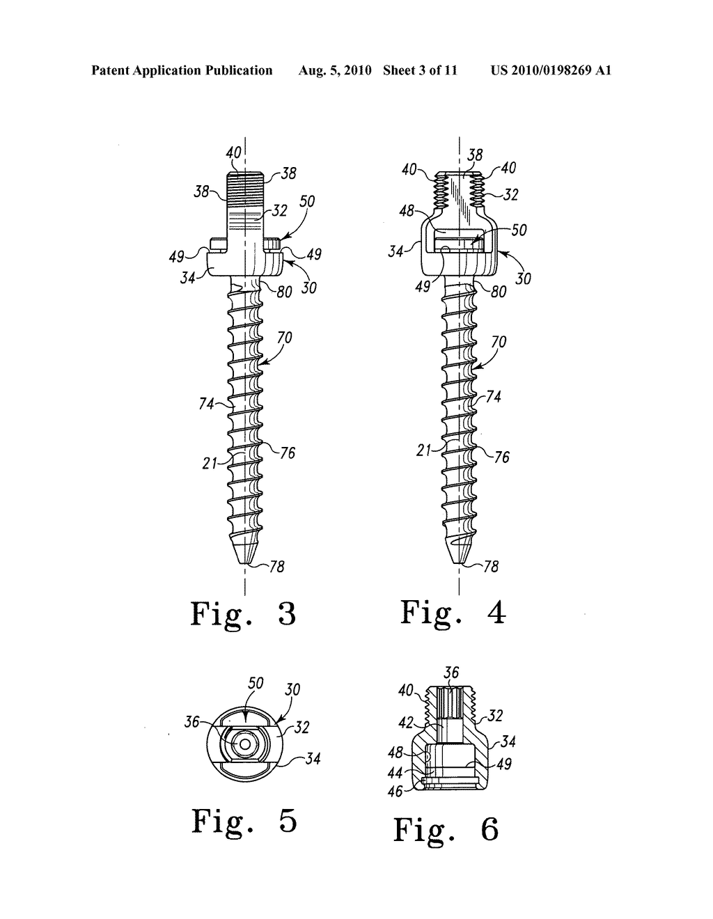 Spinal Implants with Multi-Axial Anchor Assembly and Methods - diagram, schematic, and image 04