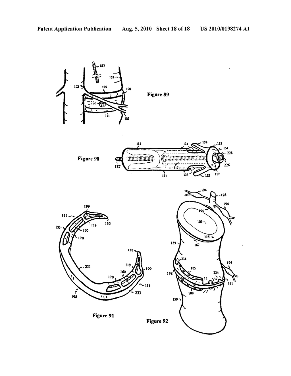 Intervertebral disc inserting device - diagram, schematic, and image 19