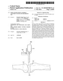 FORCE SENSING DISTAL FEMORAL ALIGNMENT SYSTEM AND METHOD OF USE diagram and image