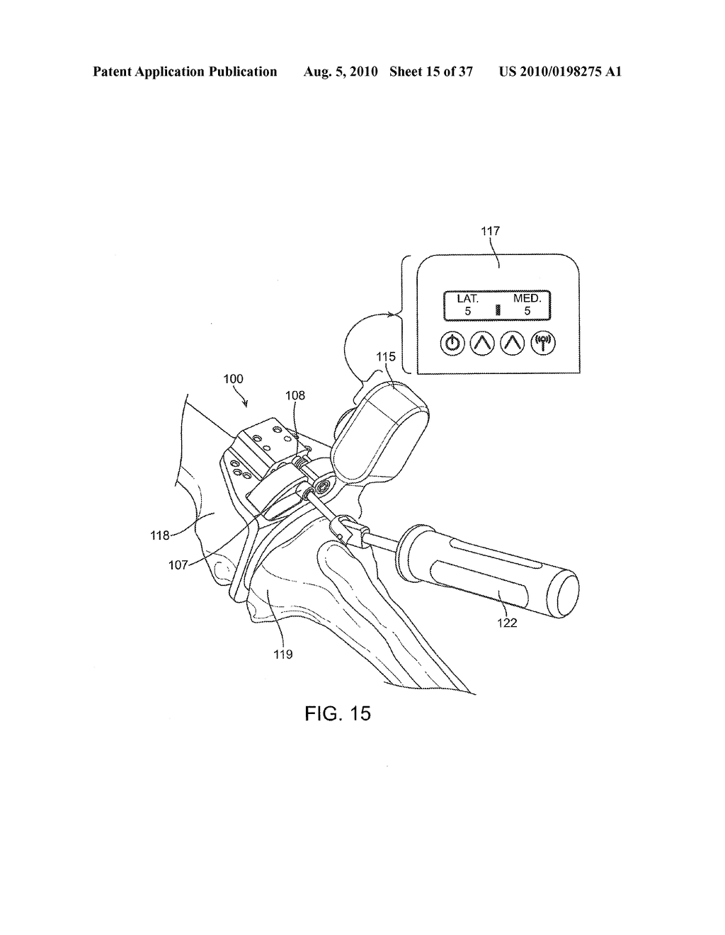 FORCE SENSING DISTAL FEMORAL ALIGNMENT SYSTEM AND METHOD OF USE - diagram, schematic, and image 16