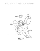 FORCE SENSING DISTAL FEMORAL ALIGNMENT SYSTEM AND METHOD OF USE diagram and image