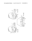 FORCE SENSING DISTAL FEMORAL ALIGNMENT SYSTEM AND METHOD OF USE diagram and image