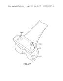 FORCE SENSING DISTAL FEMORAL ALIGNMENT SYSTEM AND METHOD OF USE diagram and image