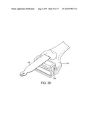 FORCE SENSING DISTAL FEMORAL ALIGNMENT SYSTEM AND METHOD OF USE diagram and image