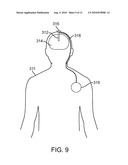 METHODS FOR TREATING DISORDERS OF PERCEPTUAL INTEGRATION BY BRAIN MODULATION diagram and image