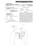 DETECTING AND TREATING ELECTROMECHANICAL DISSOCIATION OF THE HEART diagram and image