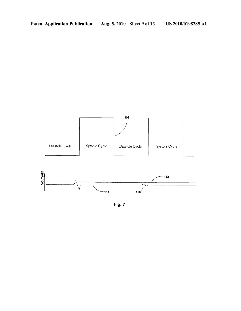 CARDIAC STIMULATION WITH HEMODYNAMIC SENSOR GUARD - diagram, schematic, and image 10