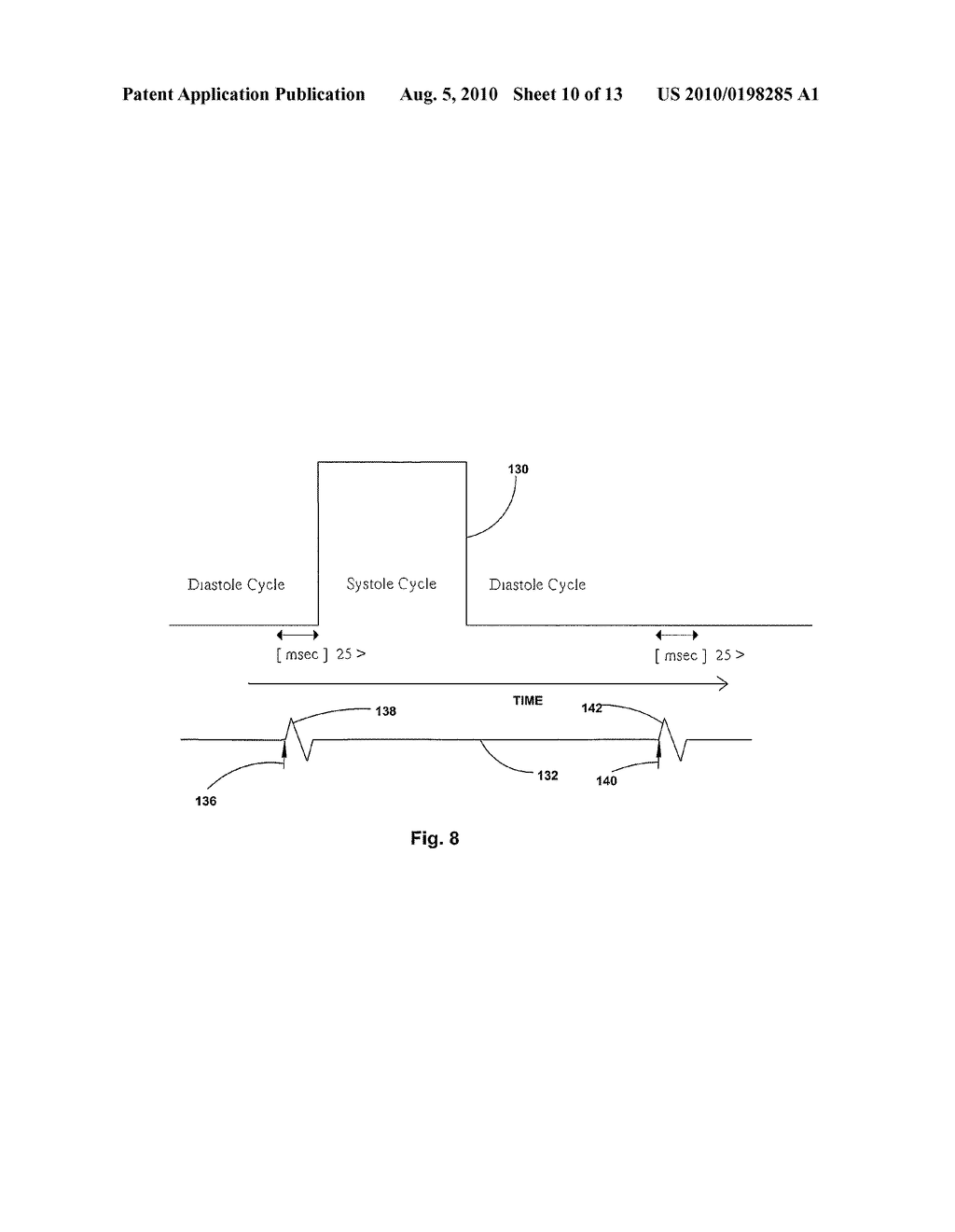 CARDIAC STIMULATION WITH HEMODYNAMIC SENSOR GUARD - diagram, schematic, and image 11