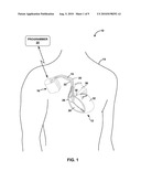 EVALUATING ELECTRODE CONFIGURATIONS FOR DELIVERING CARDIAC PACING THERAPY diagram and image