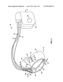 EVALUATING ELECTRODE CONFIGURATIONS FOR DELIVERING CARDIAC PACING THERAPY diagram and image