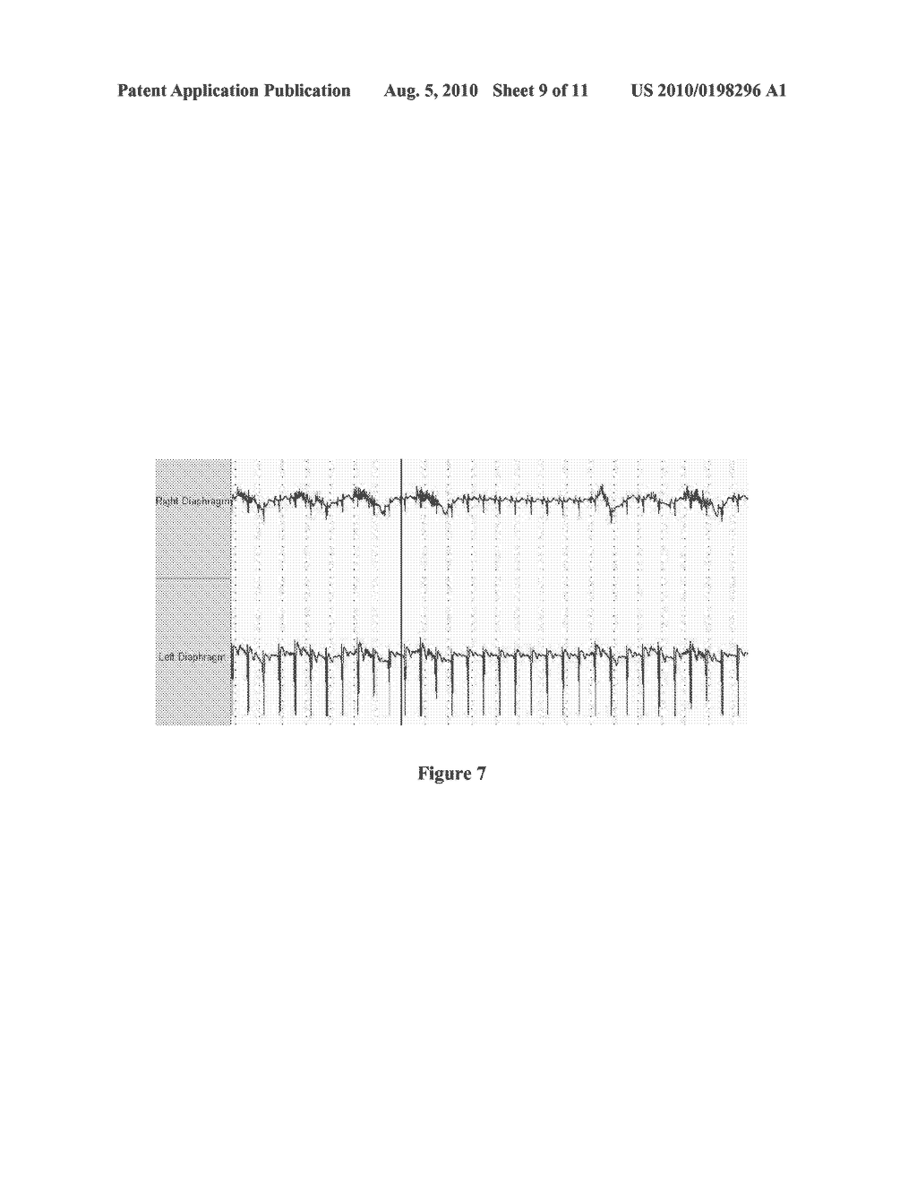 DEVICE AND METHOD OF NEUROMODULATION TO EFFECT A FUNCTIONALLY RESTORATIVE ADAPTION OF THE NEUROMUSCULAR SYSTEM - diagram, schematic, and image 10