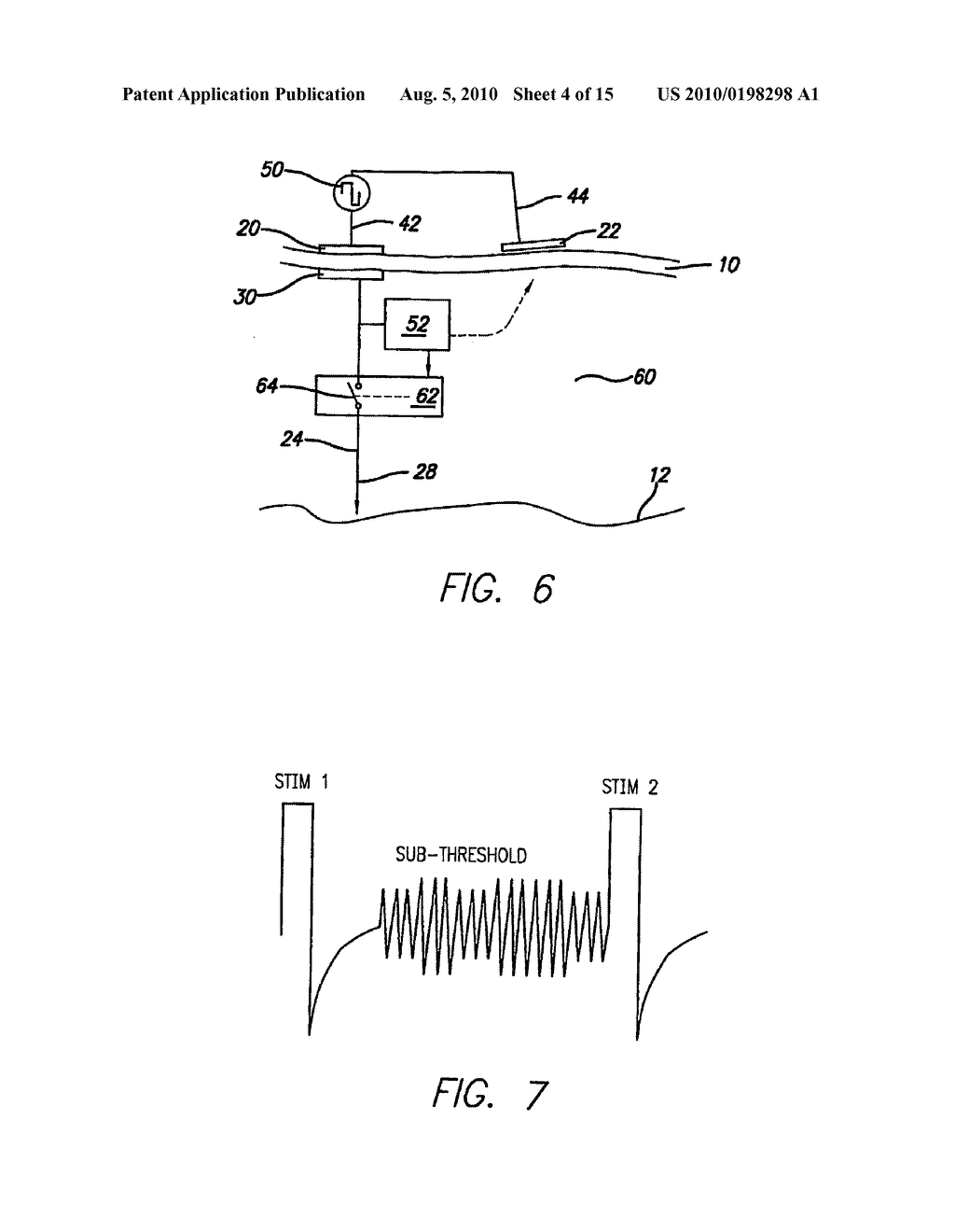 IMPLANT SYSTEM AND METHOD USING IMPLANTED PASSIVE CONDUCTORS FOR ROUTING ELECTRICAL CURRENT - diagram, schematic, and image 05