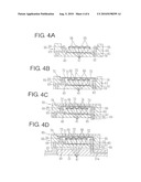 BIOLOGICAL IMPLANTABLE FUNCTIONAL DEVICE AND VISION REGENERATION ASSISTING APPARATUS diagram and image