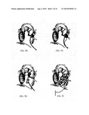 ELECTRICAL STIMULATION IN THE MIDDLE EAR FOR TREATMENT OF HEARING RELATED DISORDERS diagram and image