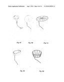 ELECTRICAL STIMULATION IN THE MIDDLE EAR FOR TREATMENT OF HEARING RELATED DISORDERS diagram and image