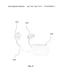 ELECTRICAL STIMULATION IN THE MIDDLE EAR FOR TREATMENT OF HEARING RELATED DISORDERS diagram and image