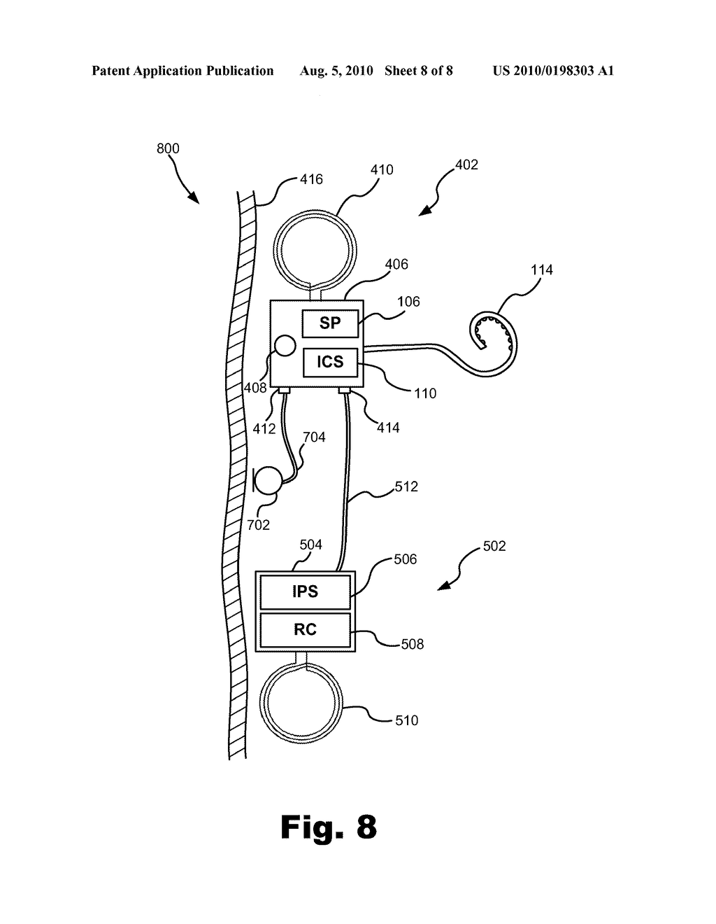 MODULAR COCHLEAR IMPLANT SYSTEMS INCLUDING IMPLANTABLE SOUND PROCESSORS - diagram, schematic, and image 09