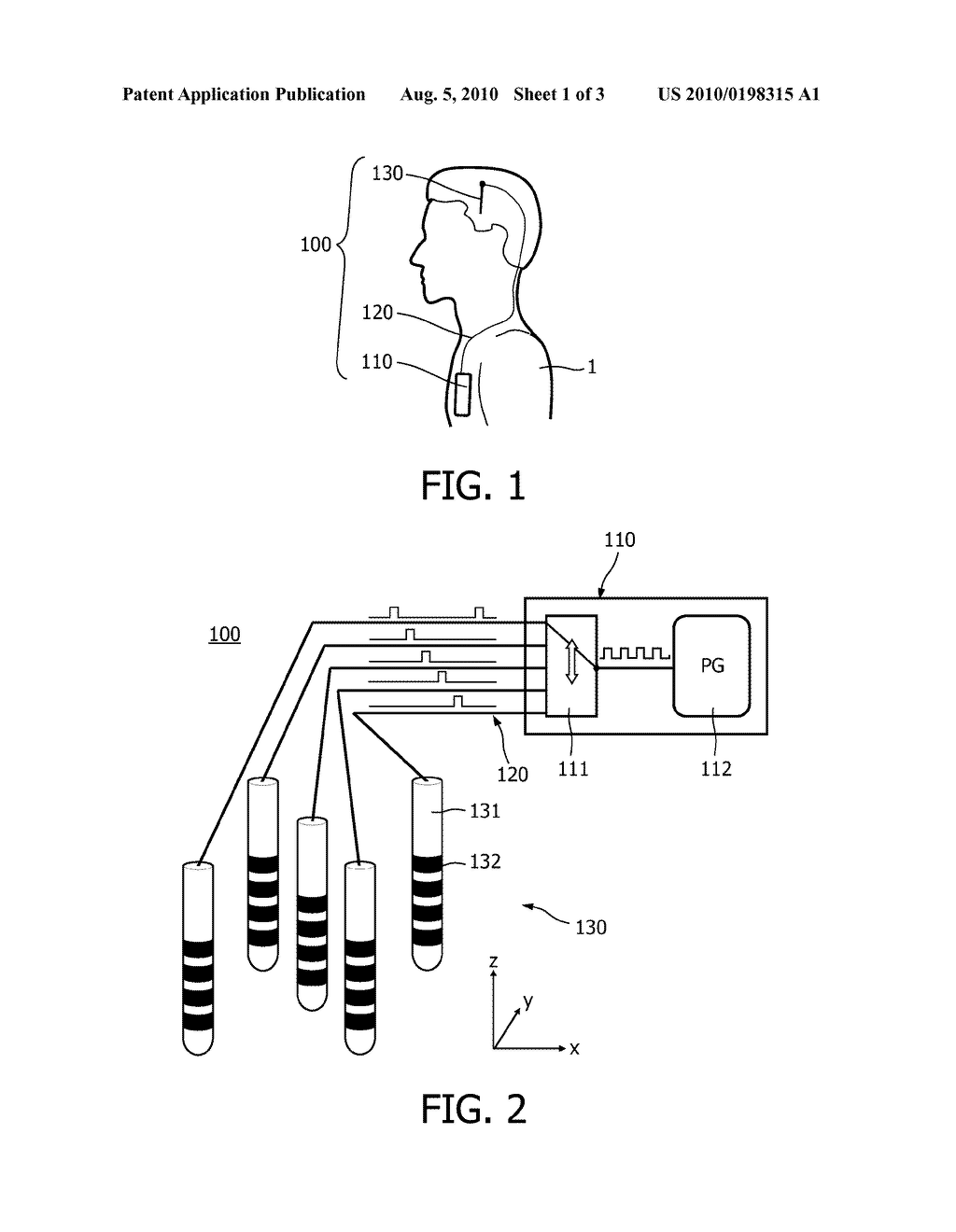 NEUROSTIMULATION SYSTEM - diagram, schematic, and image 02